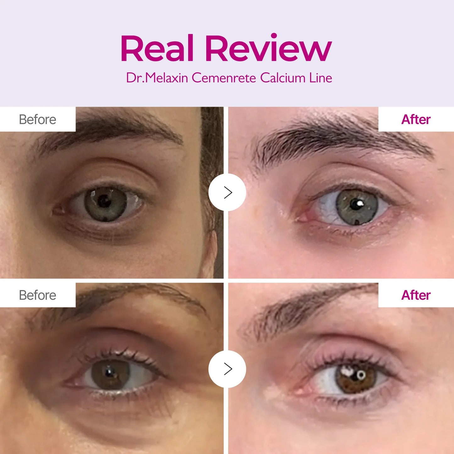 Calcium Eyecare Routine Set