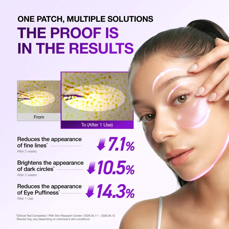 [Anua] Retinol Berry Revitalizing Eye Patch for Wrinkle and Dark Circles(60ea), 8Hour Plumping Effect in 10 Minutes, Fuller Looking & Lifted Skin, Hyal-Plumping Effect, Brightens Undereye by Antioxidant Berry Extracts, Relieves Puffiness with Caffeine