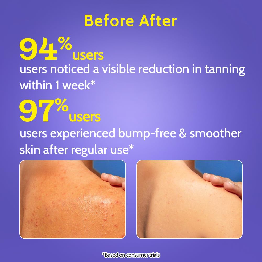 Chemist at Play Body Wash Exfoliating For Dry Rough Bumpy Strawberry Skin With 1% Salicylic Acid 2% Lactic Acid And Ceramides For Men And Women 7.9 Fl oz
