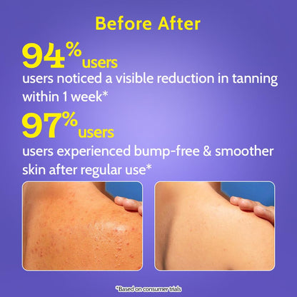 Chemist at Play Body Wash Exfoliating For Dry Rough Bumpy Strawberry Skin With 1% Salicylic Acid 2% Lactic Acid And Ceramides For Men And Women 7.9 Fl oz