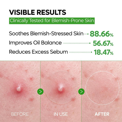 Dr.Melaxin S-ZINC ZERO-FIT Ultra Thin Blemish Spot Patch 0.013mm Invisible Pimple Stickers with Sulfur, Salicylic Acid, AHA & PHA, Seamless Under Makeup Face Cover, 12mm x 72 Patches